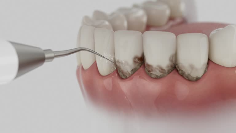 Reliable Dental Implants contractor in Iola, WI by Smile Center Dentistry